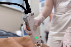 Лазерная эпиляция и удаление пигментации на аппарате Clarity II