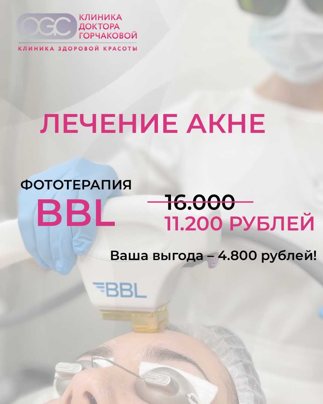 Спецпредложение: BBL против акне за 11 200 ₽